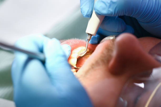 Best Mobile Emergency Dentist in Bettendorf, IA